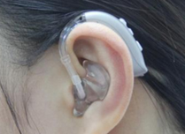 为什么戴助听器时常会觉得耳闷